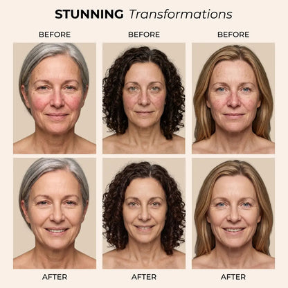 Melya™ Changing Foundation For Rosacea